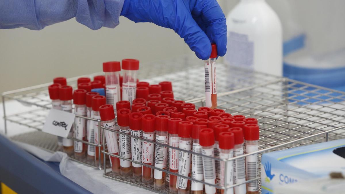 Tubos para la detección del COVID por test PCR. Los restos tras la eliminación del virus no son detectables por PCR.