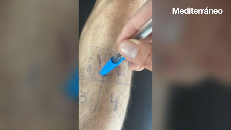 Vídeo | Así son algunos de los ejercicios en la recuperación de una operación de ligamento cruzado anterior y menisco