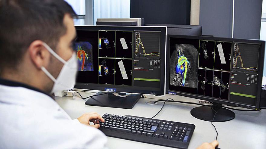 Ascires crea un gemelo digital de la aorta para mayor precisión en el diagnóstico y pronóstico de cardiopatías