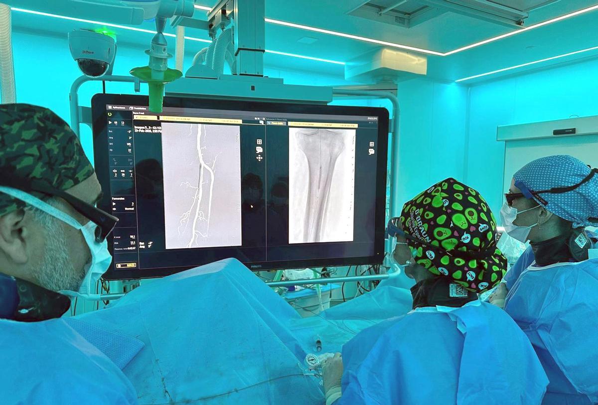 Professionals del Servei d'Angiologia i Cirurgia Vascular del Trueta durant la intervenció d'implant del dispositiu reabsorbible en artèries distals de la cama per sota del genoll.