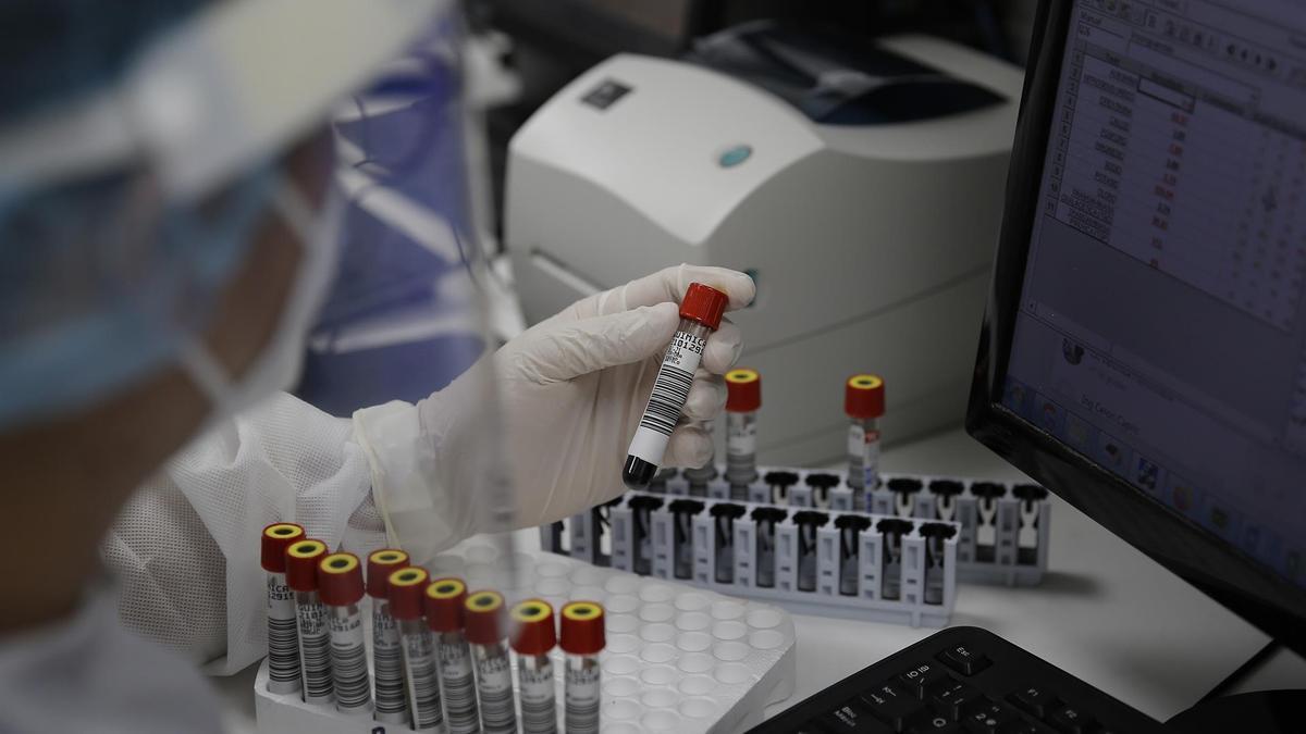 Pruebas de diagnóstico de covid en un laboratorio.