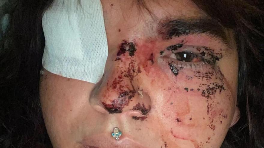 Una mujer sufre una brutal agresión tránsfoba en León: «Me duele todo, pero sigo en pie»