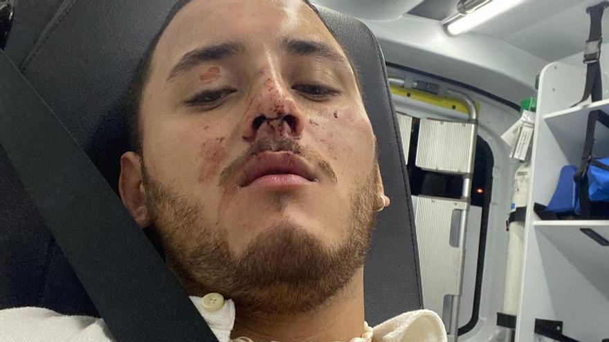 Un joven denuncia una agresión de dos vigilantes de seguridad en una discoteca de Alicante