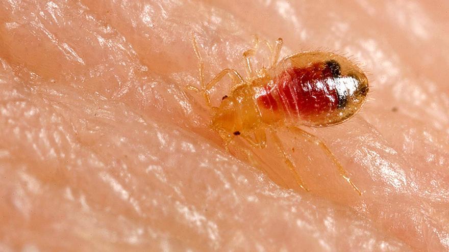 Qué son las chinches: así es el insecto detectado en el Hospital Príncipe de Asturias de Alcalá