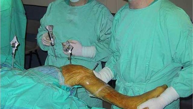El especialista Daniel Hernández Vaquero, a la izquierda, con  su equipo colocando una prótesis de rodilla.