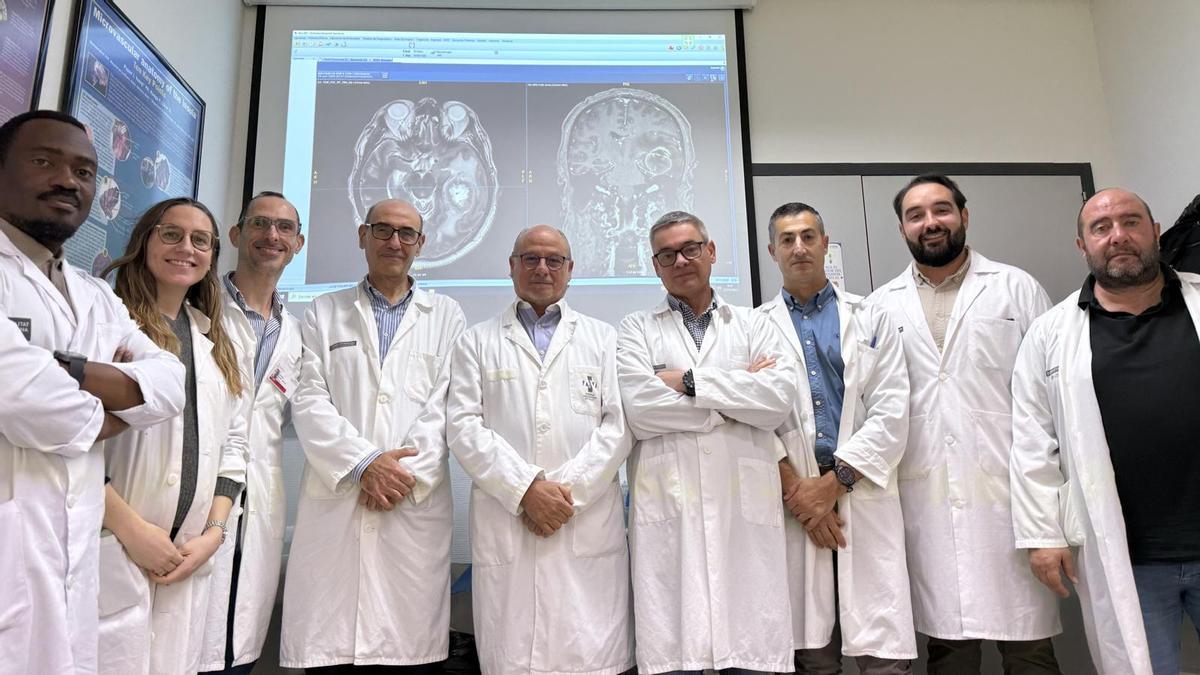 Equipo de neurocirujanos del Hospital de la Ribera.