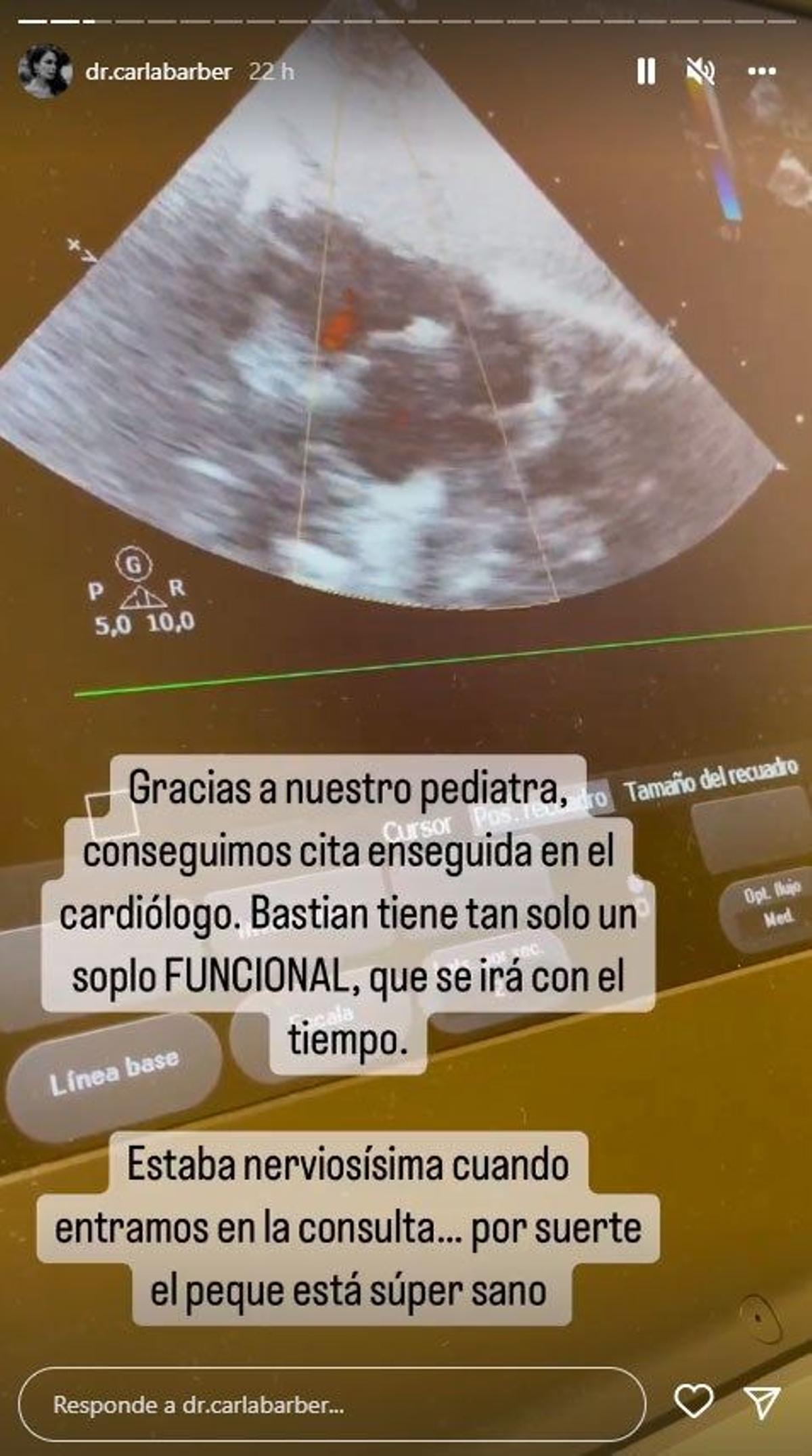 Un Instagram Stories de Carla Barber