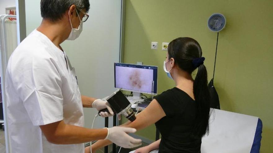 Los tumores de piel intervenidos en España durante el confinamiento se redujeron en un 40 por ciento