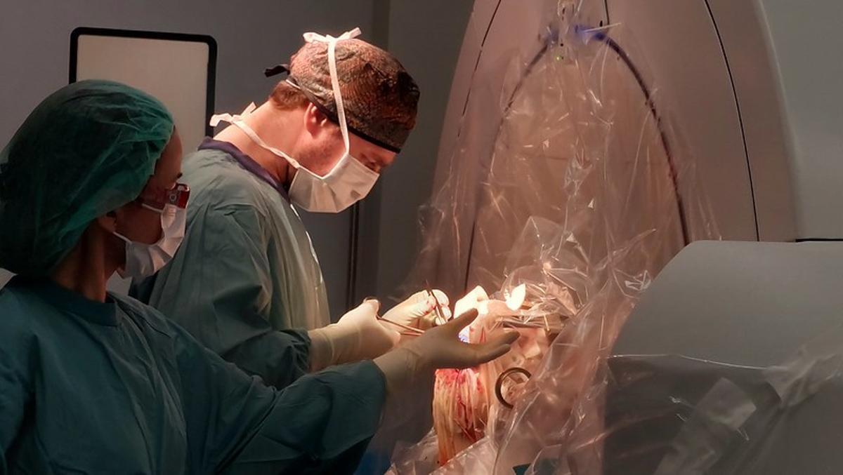 Un momento de la cirugía de estimulación cerebral profunda a un paciente son síndrome de Tourette.