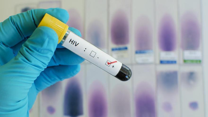 Identifican un perfil de personas capaces de controlar el VIH sin tratamiento