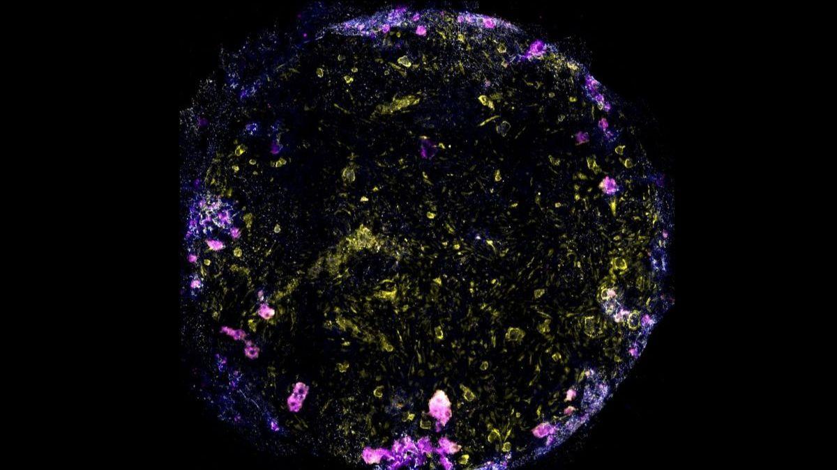 Desarrollan el primer «pulmón en un chip» usando células madre