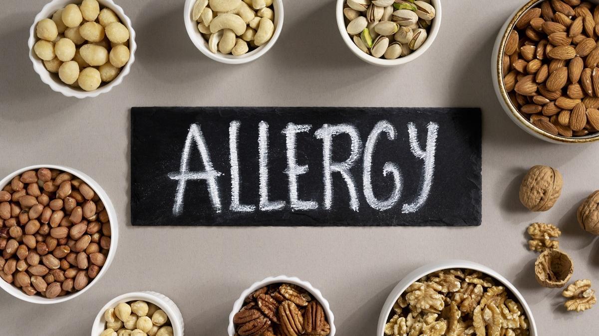Un 40% de los niños con alergias alimentarias no consiguen superarlas