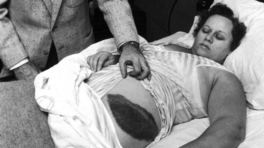 Meteoric coincidence: a fireball like the one in the Canary Islands already hit a person 68 years ago