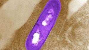 Bacteria listeria.