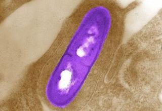 ¿Qué es la listeriosis? ¿Cuáles son sus síntomas? ¿Cómo se trata?