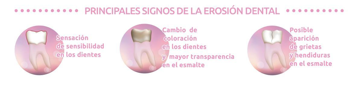 ¿Cómo saber si el esmalte está erosionado?