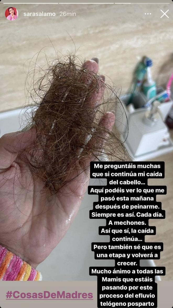 Sara Sálamo actualiza la situación sobre su caída de pelo en el posparto