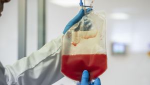 Les noves teràpies revolucionen les patologies de la san