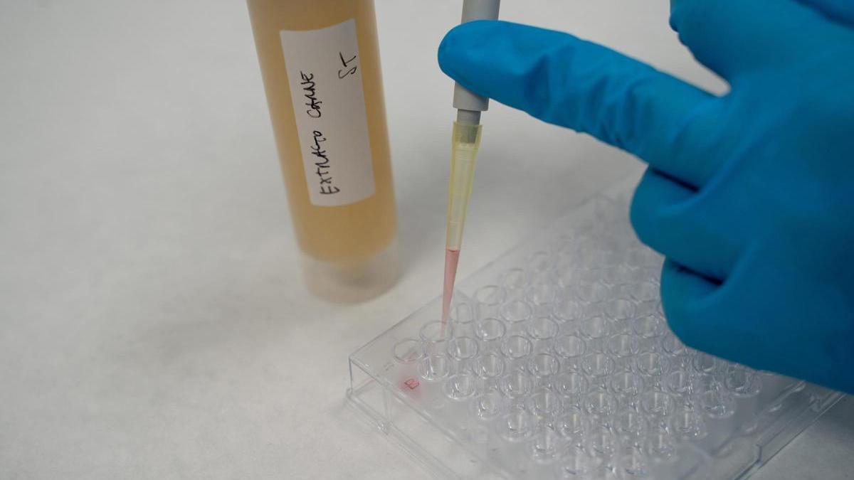 Prueba de laboratorio. Archivo.
