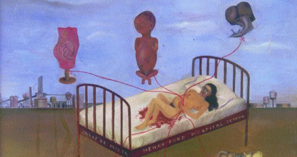 HOSPITAL HENRY FORD (1945)En este cuadro, Frida se inspiró en ilustraciones médicas para reproduc