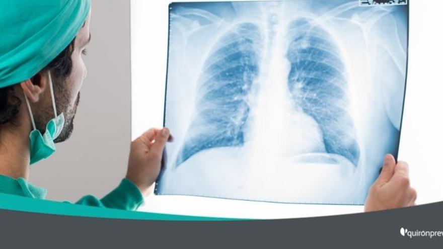 Els pneumòlegs promouen el cribratge del càncer de pulmó