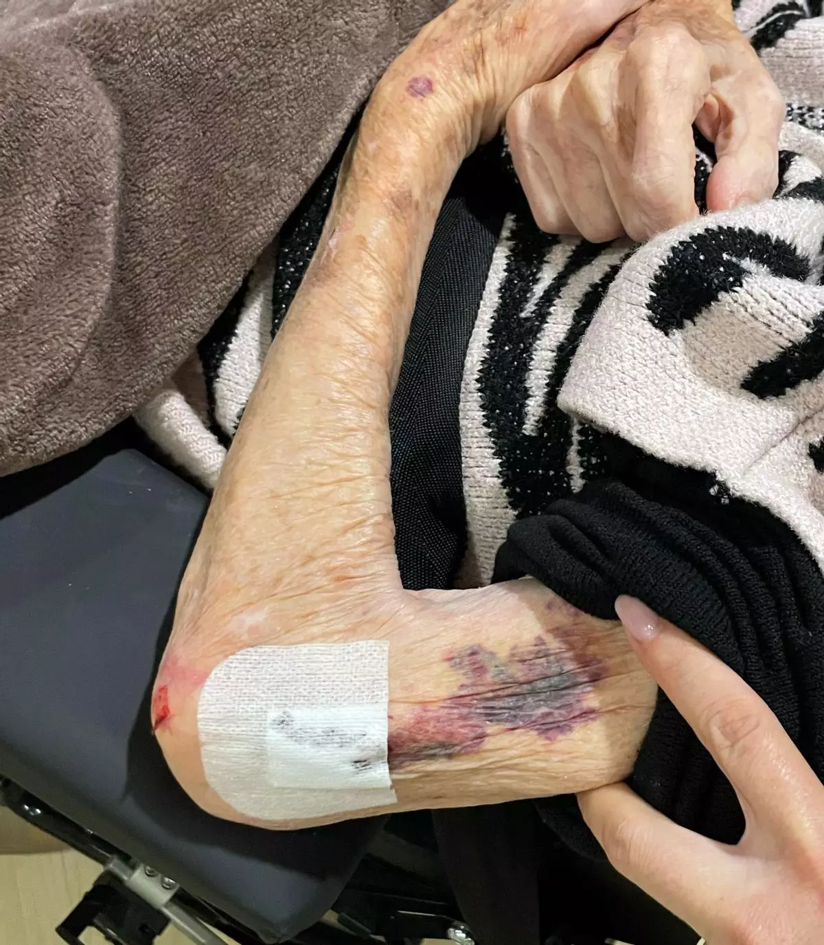 Denuncian a una residencia de Marratxí ante la Guardia Civil por una deficiente atención a una anciana