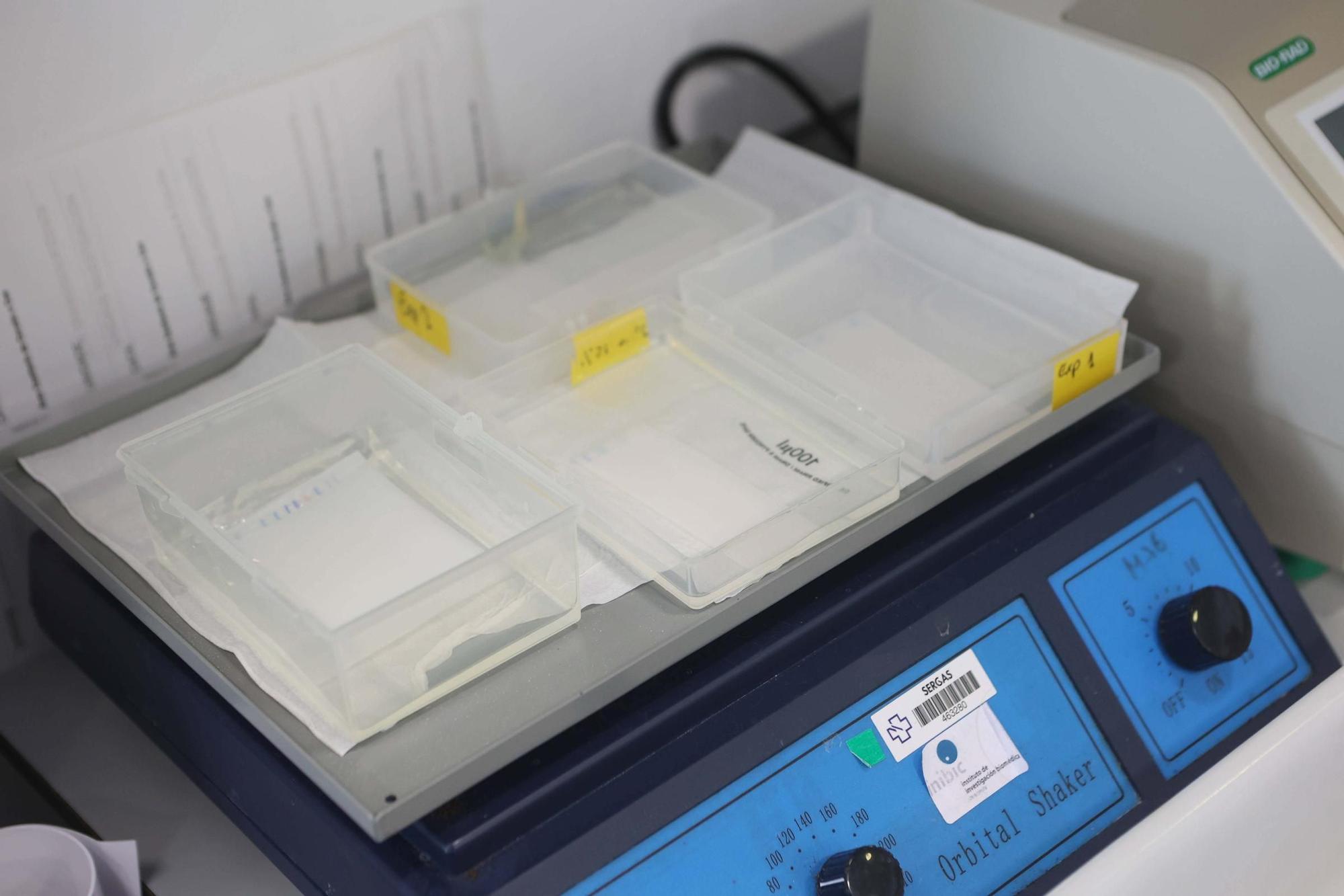 El conselleiro de Sanidade visita el Instituto de Investigación Biomédica de A Coruña