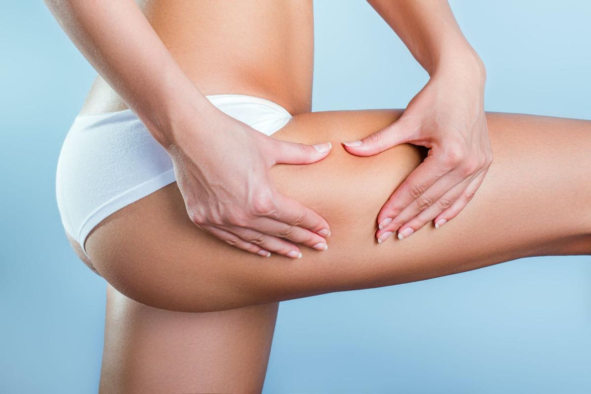 Celulitis pierna mujer