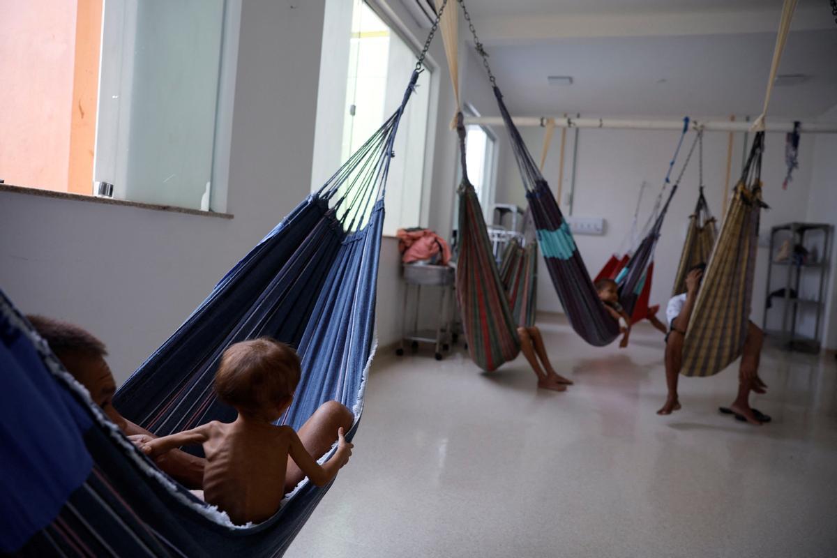 Niño indígenas yanomami desnutridos reciben tratamiento en el Hospital Infantil Santo Antonio en Boa Vista, estado de Roraima, Brasil.