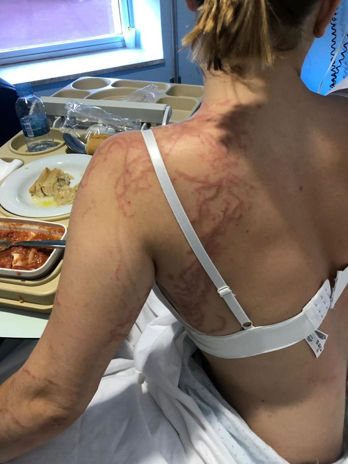 Una carabela ataca a una chica de 22 años en Calnegre: &quot;Creía que me moría&quot;