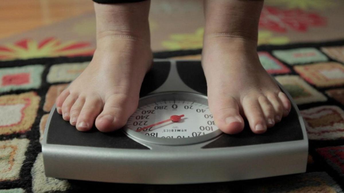 Un joven con obesidad se pesa en una báscula.