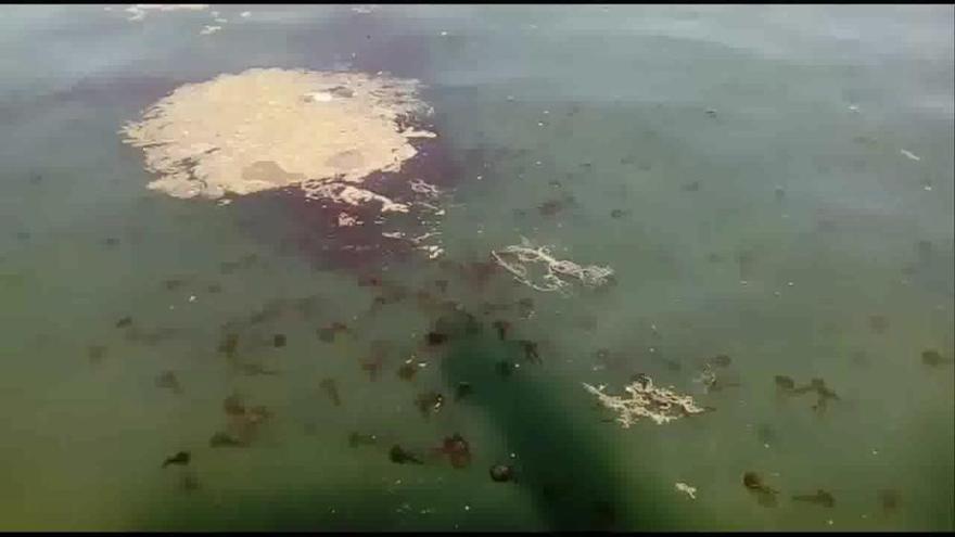 Medusas en la playa de Malapesquera