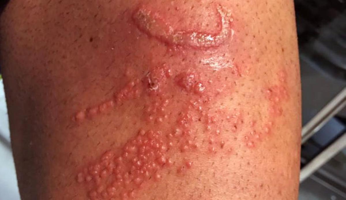 Así es la aguaviva Pelagia que navega por el mar de Las Canteras