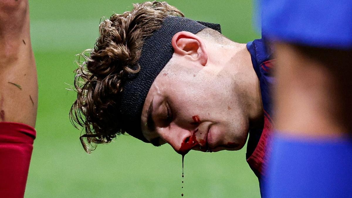 Gavi pensó que se había jodido pero bien (y estuvo 11 meses sin jugar)