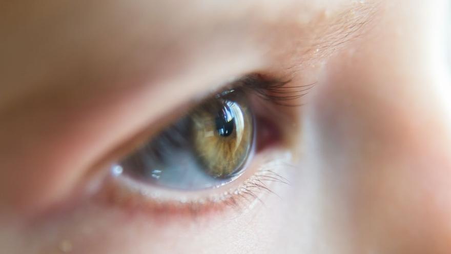 Retinoblastoma infantil: el cáncer que se manifiesta con un destello blanco en los ojos al sacar una foto