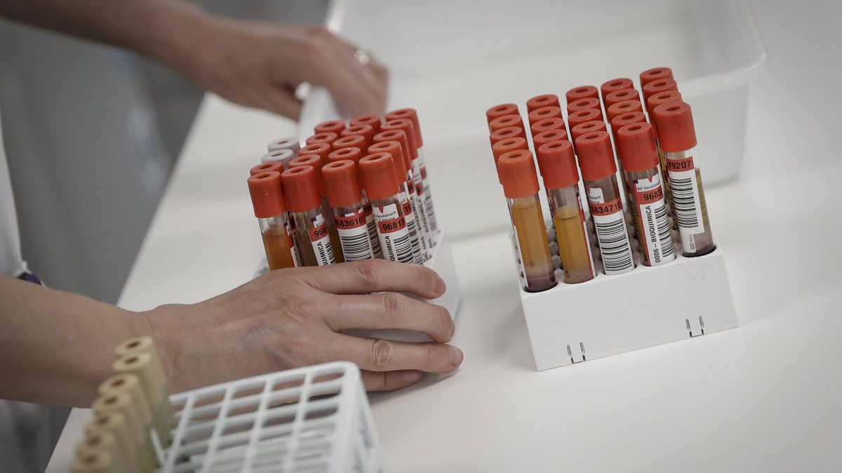 Muestras de sangre en el laboratorio de Análisis Clínicos de Son Espases.