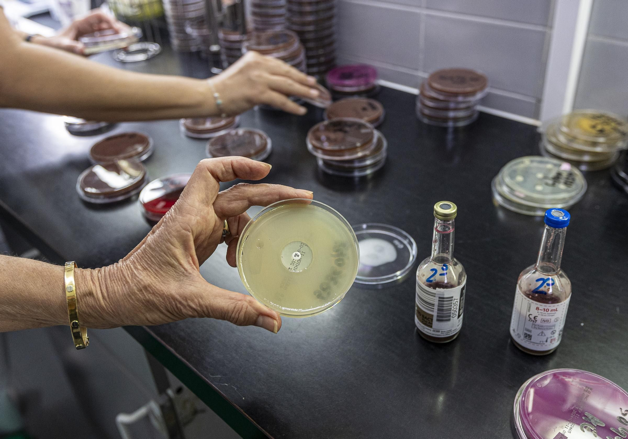 Protocolo para optimizar la respuesta rápida en código sepsis en Alicante