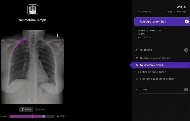 Telefónica crece en el negocio sanitario y se refuerza en el uso de la IA para hacer diagnósticos médicos