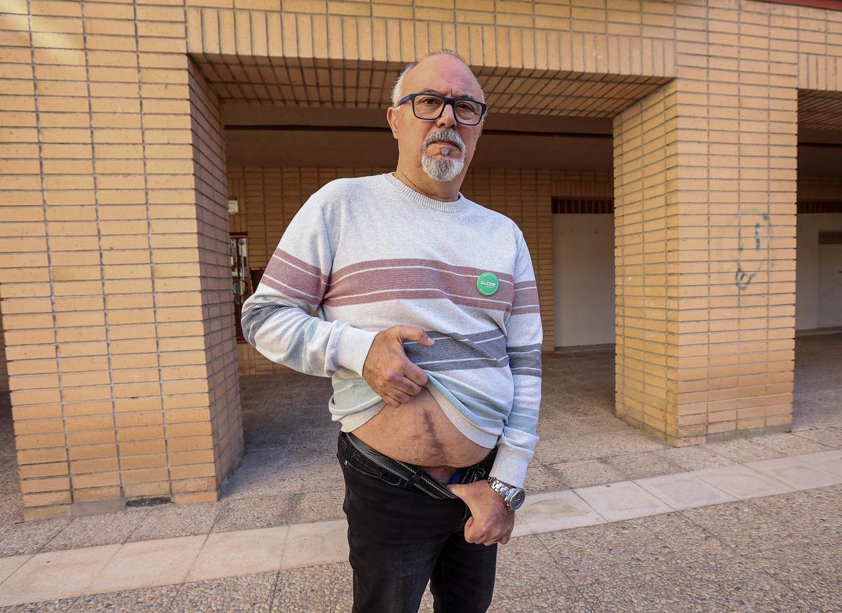 Miguel López Pons se sometió a un trasplante de riñón