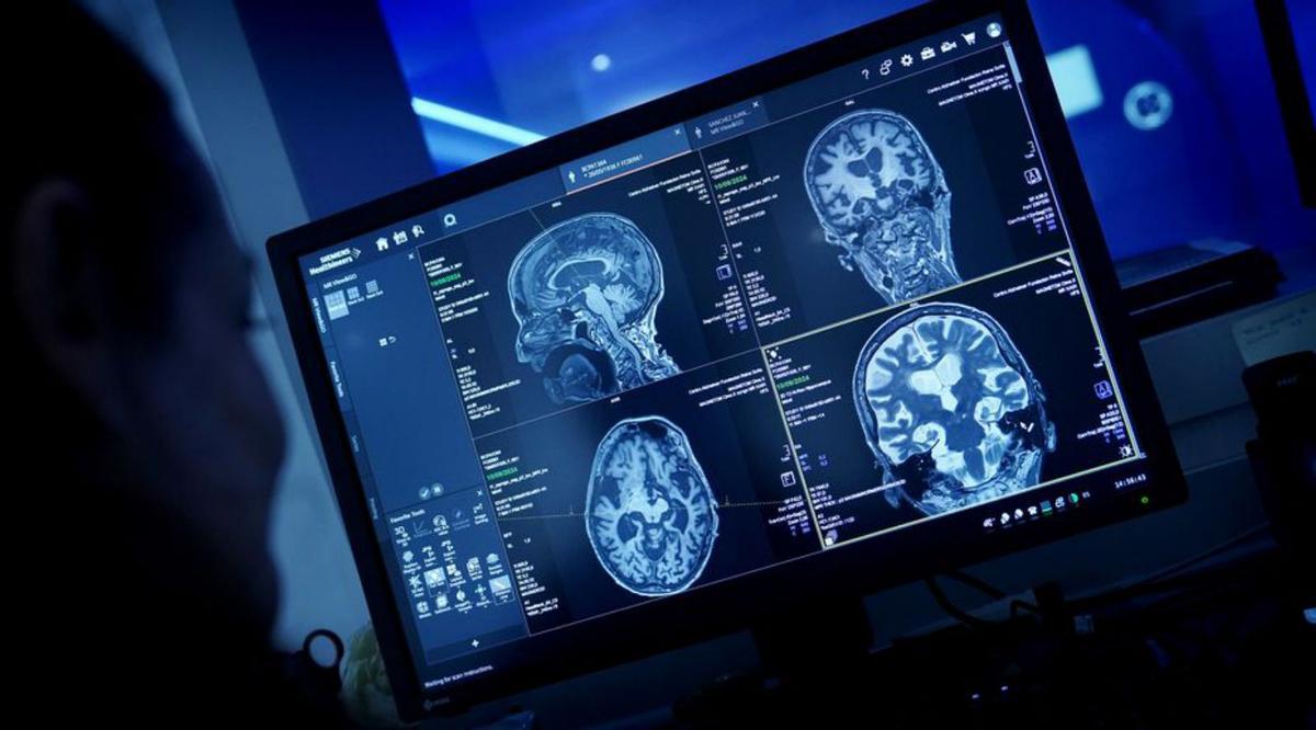 La sanitat pública ofereix una teràpia innovadora per al tumor cerebral