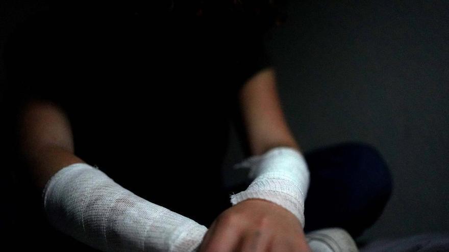 Más institutos de Plasencia han detectado casos de autolesiones en estudiantes por retos virales