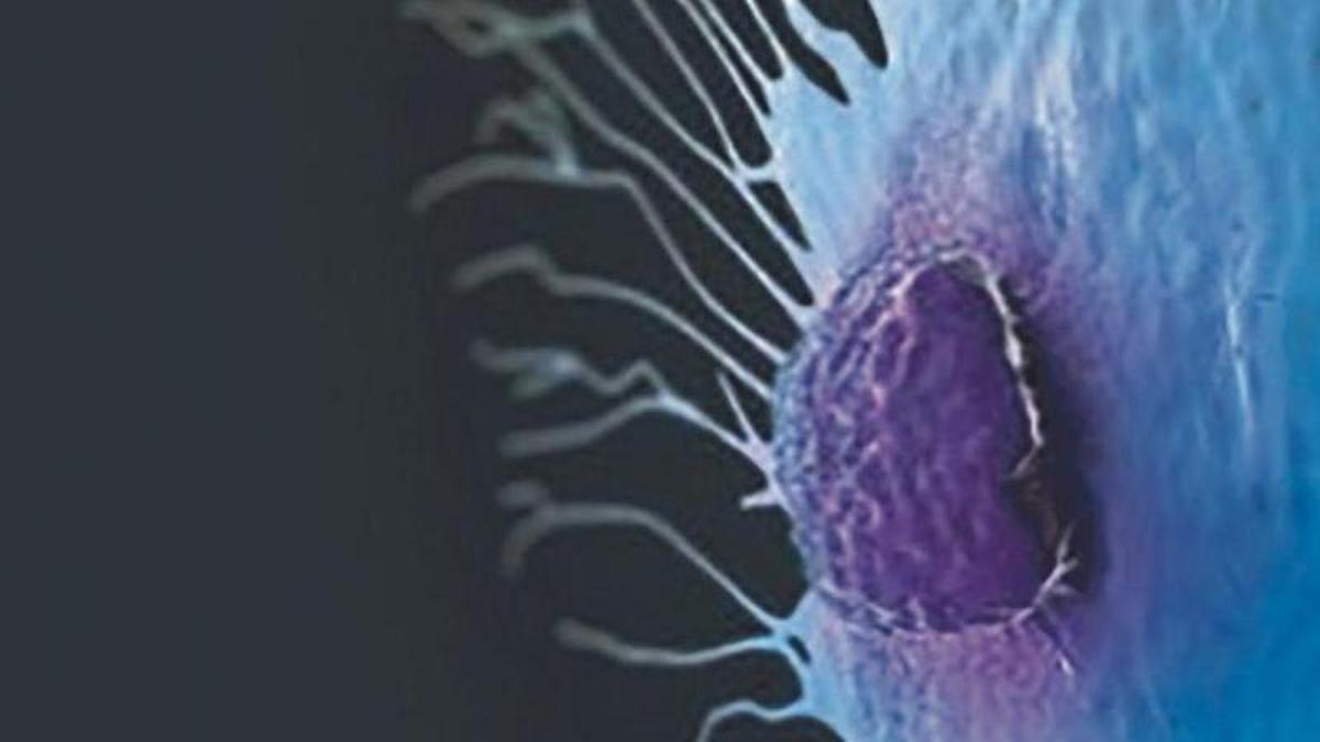 Imagen científica de una célula de cáncer de mama migratoria
