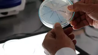 Cuatro muertos en Florida por una bacteria carnívora presente en el mar