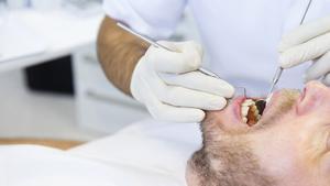 Archivo - Dentista, boca, paciente. Periodontitis.
