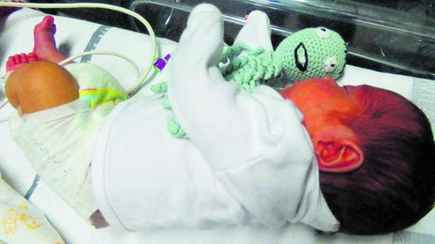 Un bebé recién nacido y prematuro hospitalizado.  | | LP/DLP
