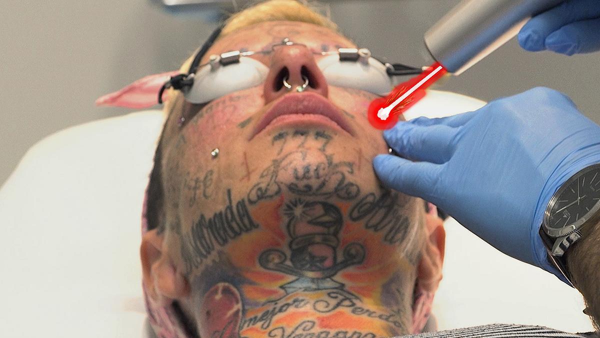 La dona més tatuada d’Europa s’esborra els tatuatges de la cara.