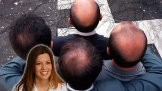 Buenas noticias para los de poco pelo: Una dermatóloga habla claro sobre quedarse calvo