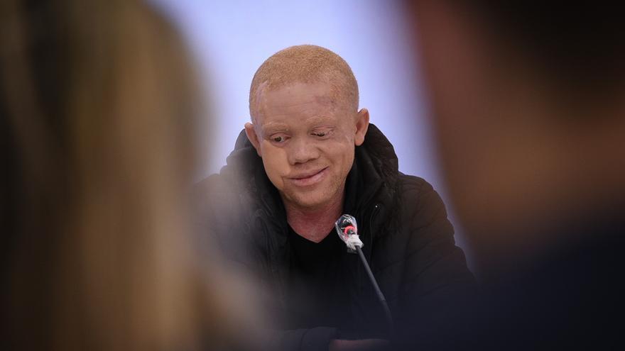 El doctor Cavadas interviene a un joven albino guineano de un cáncer facial