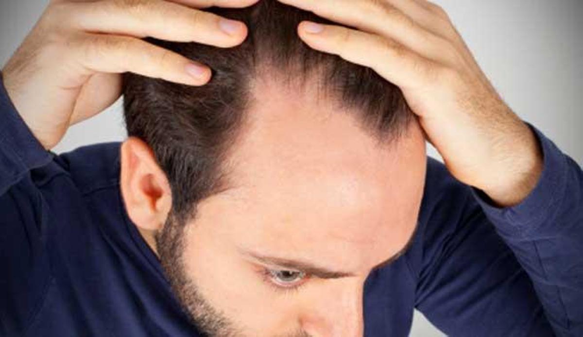 Muchos consumidores invierten grandes sumas de dinero con la esperanza de frenar la caída del cabello.