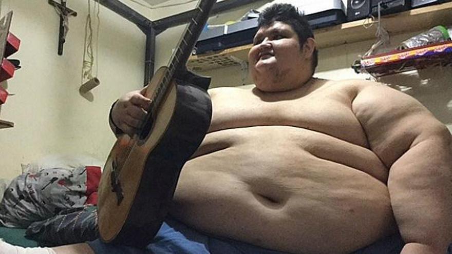 El hombre más obeso del mundo inicia un tratamiento para bajar de los 500 kilos